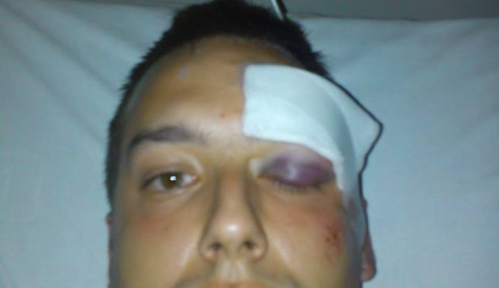 Sražený mladík krátce po nehodě