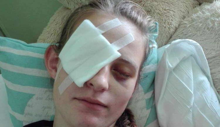 Mladou hasičku zasáhl proud vody přímo do očí.