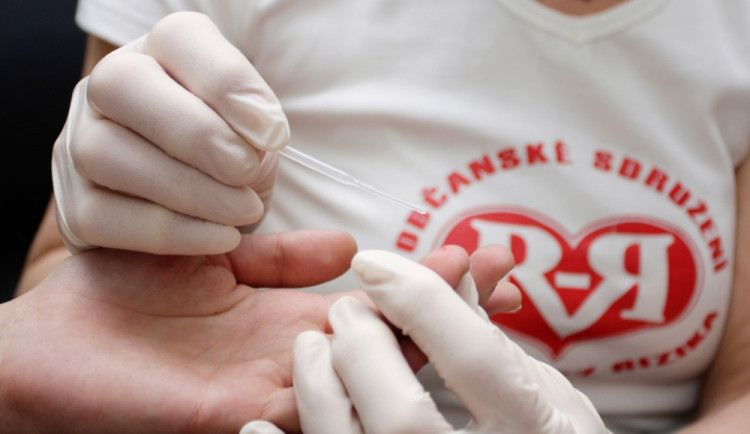 Za tři čtvrtletí se nakazilo HIV 162 lidí, o 32 méně než loni