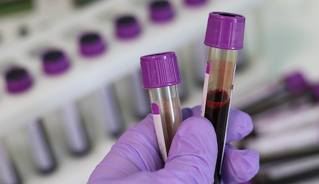 Ilustrační snímek