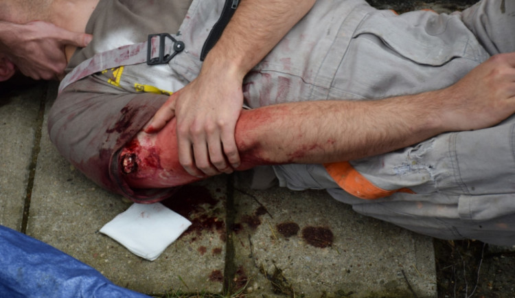 Jeden ze zraněných.