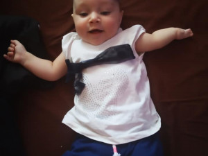 Nikolka, ač se narodila s vzácnou vadou, je krásná usměvavá holčička.