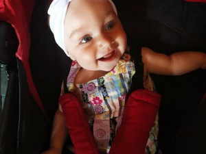 Nikolka, ač se narodila s vzácnou vadou, je krásná usměvavá holčička.