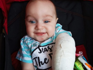 Nikolka, ač se narodila s vzácnou vadou, je krásná usměvavá holčička.