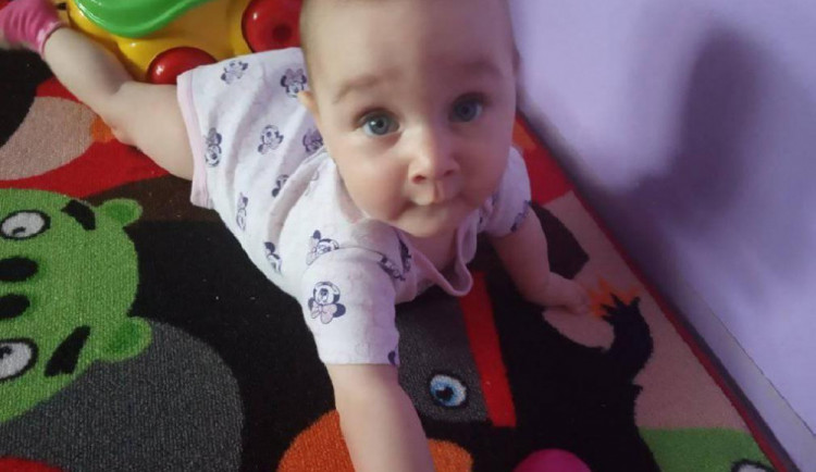 Nikolka, ač se narodila s vzácnou vadou, je krásná usměvavá holčička.