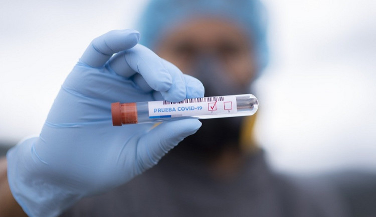 Přes 800 tisíc půjde do nemocnic na dorovnání cen PCR testů