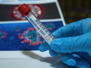 Britskou mutaci koronaviru testy potvrdily i v Libereckém kraji. Prokázala se u tří čtvrtin vzorků