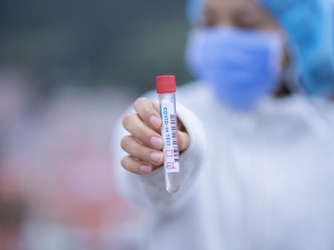 Nejvíc případů od začátku epidemie. Testy potvrdily v pátek v Libereckém kraji covid u 962 lidí