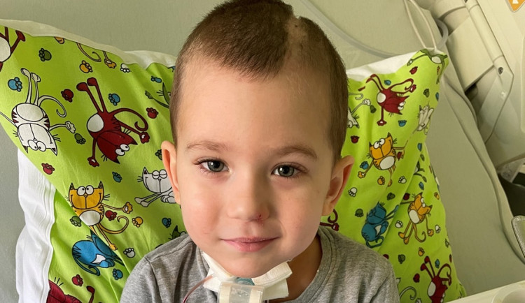 Malý Eddie prodělal bezpříznakový covid. Následkem bylo krvácení do mozku, k tomu obrna hlasivek