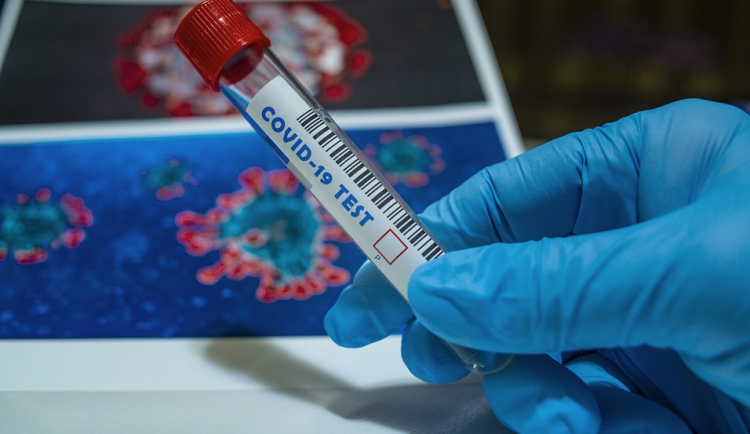 Podle analýzy se v Liberci na 90 procent potvrdila varianta koronaviru omikron. Bude se dál zkoumat