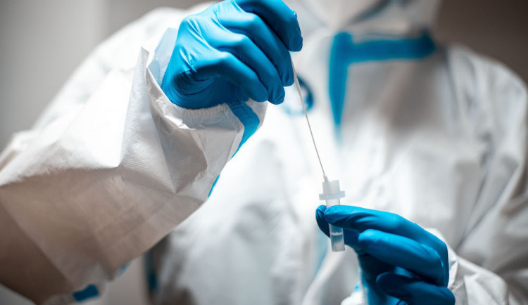 Nemocnice budou od února zpracovávat denně o třetinu koronavirových testů více