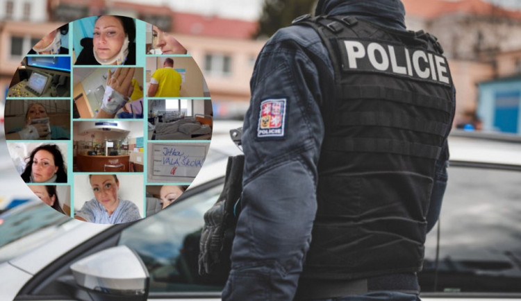 Žena z Brna na Facebooku tvrdila, že ji zmlátili Ukrajinci. Kamery nic neviděly