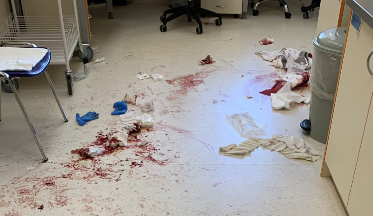 Drama v Českých Budějovicích. Muž zaútočil mačetou na psychiatrickém oddělení