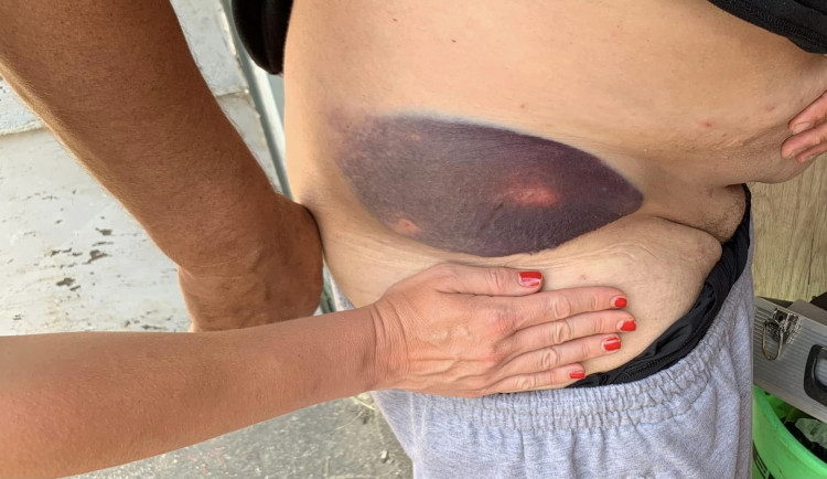 Napadli mě, tvrdí rybář. Několikrát do něj najel motorový člun