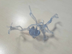 Spravit prasklý obratel na milimetr přesně dokážou v Liberci i díky 3D tisku. Vytisknout se dá nádor i cévy