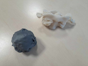 Spravit prasklý obratel na milimetr přesně dokážou v Liberci i díky 3D tisku. Vytisknout se dá nádor i cévy