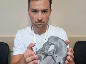 Spravit prasklý obratel na milimetr přesně dokážou v Liberci i díky 3D tisku. Vytisknout se dá nádor i cévy
