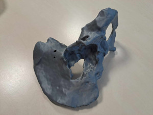 Spravit prasklý obratel na milimetr přesně dokážou v Liberci i díky 3D tisku. Vytisknout se dá nádor i cévy