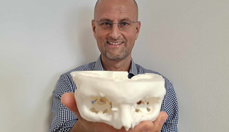 Zakladatel České společnosti pro 3D tisk v medicíně Lukáš Čapek.