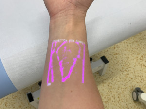 Speciální přístroj pomáhá snížit u dětských pacientů strach z odběrů krve