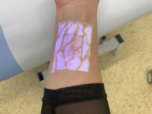 Speciální přístroj pomáhá snížit u dětských pacientů strach z odběrů krve