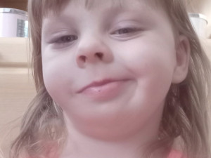 Dominik se narodil se třemi oušky a rozštěpem rtu, lékaři u něj objevili vzácné onemocnění