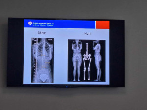 V Liberci vznikla laboratoř pohybové medicíny. Jako jediná v Česku kombinuje několik technologií