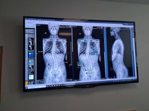 V Liberci vznikla laboratoř pohybové medicíny. Jako jediná v Česku kombinuje několik technologií