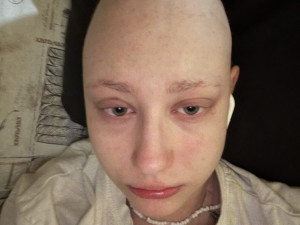 Dva roky boje s leukémií. Život Terezy z Hané zachránila i stovka přípravků od dárců krve