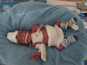 Když se narodili, vážili dohromady necelých 1200 gramů. Do života to Matějovi a Šimonovi přineslo řadu zdravotních problémů