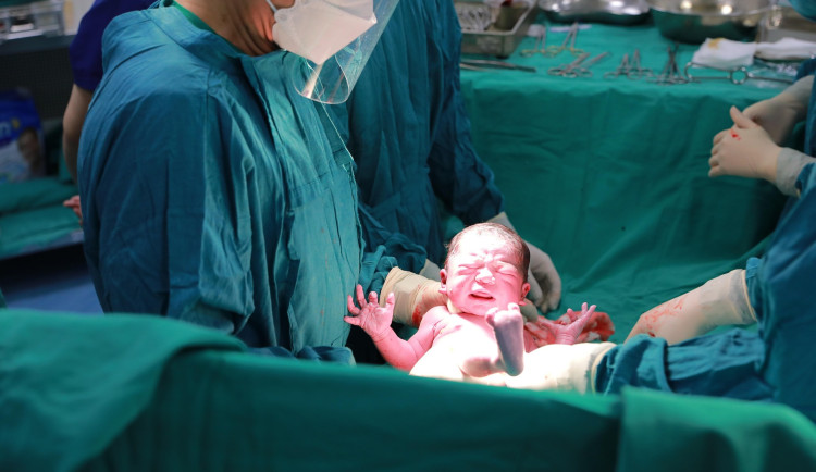 Ilustrační foto císařský řez.