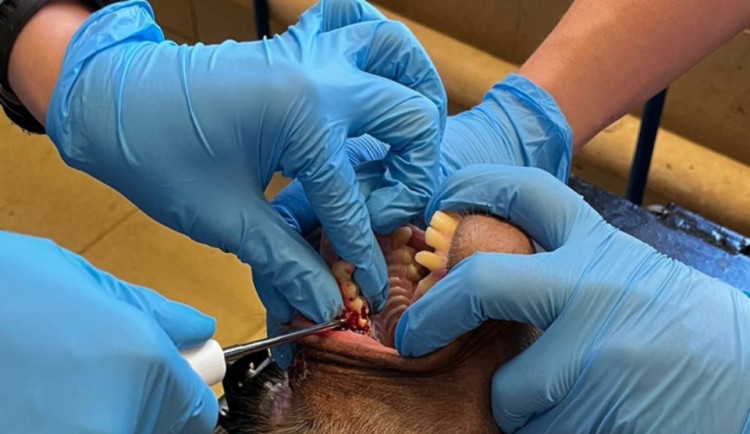 Paviánici v liberecké zoo pomáhala lidská zubařka. Vytrhla jí zkaženou stoličku