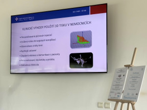 Přelomová novinka v liberecké nemocnici – vytiskne si implantáty na 3D tiskárně