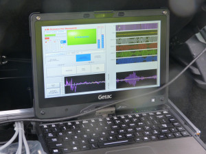 Detektor tlukotu srdce.