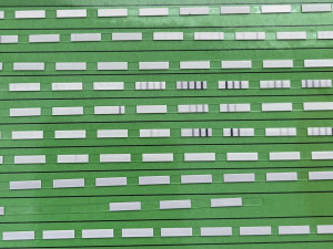 Na jarní alergie platí procházky po dešti, odborníci radí i další fígle