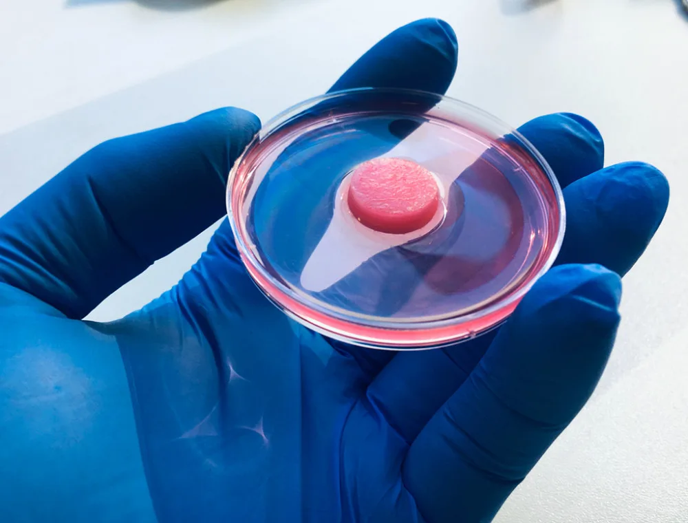 Organoid brzlíku.