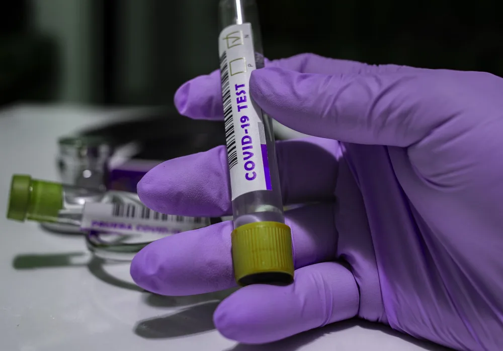 Antigenní testy v Libereckém kraji dostala jen některá zařízení