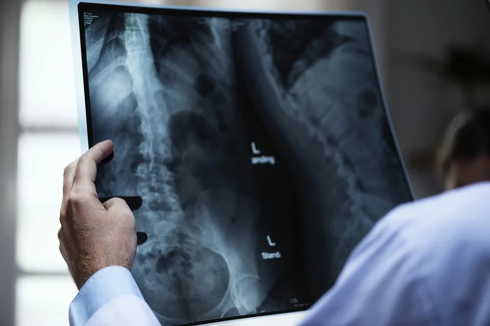 Ročně zemře přes pět tisíc Čechů na rakovinu plic, počet má snížit screening