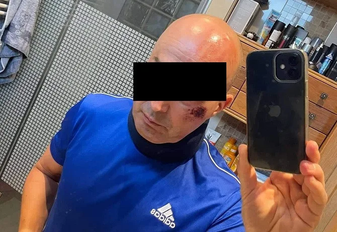 Cyklista se na Českolipsku střetl s traktorem, zachránila jej přilba. Kolo se silným nárazem rozlomilo
