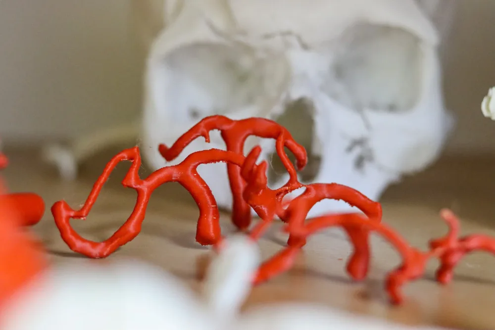 Lékařům v liberecké nemocnici pomáhá 3D tisk. Mohou navrhovat implantáty, tisknout kosti i nádory