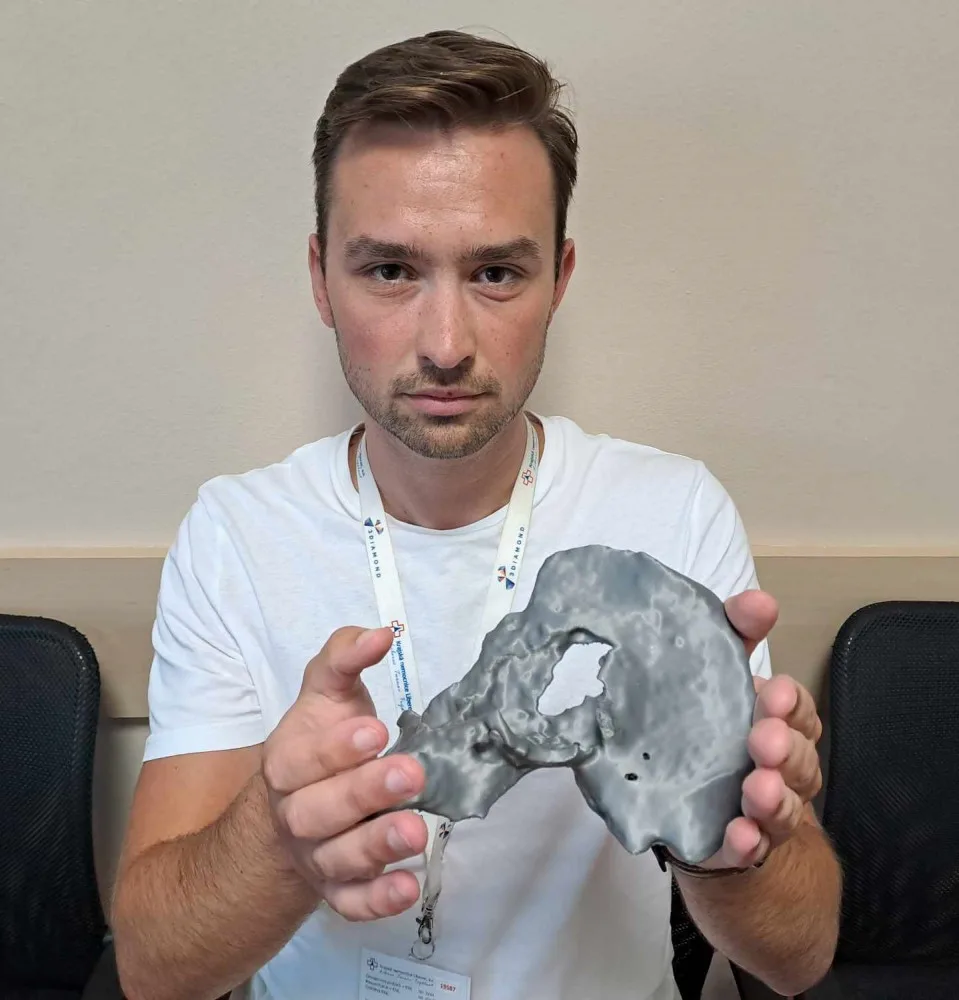 Spravit prasklý obratel na milimetr přesně dokážou v Liberci i díky 3D tisku. Vytisknout se dá nádor i cévy