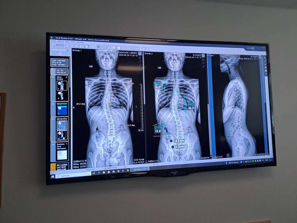 V Liberci vznikla laboratoř pohybové medicíny. Jako jediná v Česku kombinuje několik technologií