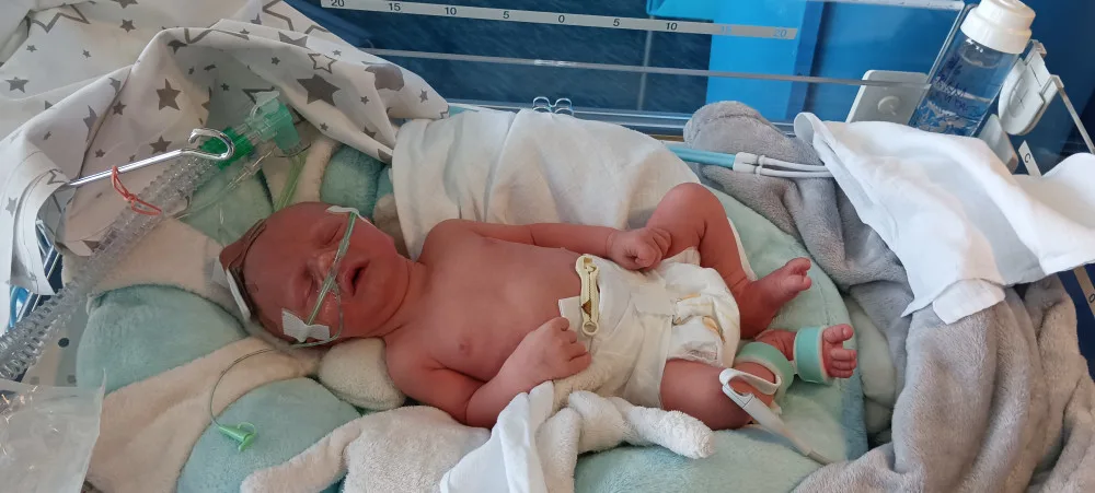 Vdechl plodovou vodu a prodělal tracheostomii. Půlroční Jiříček teď potřebuje speciální péči