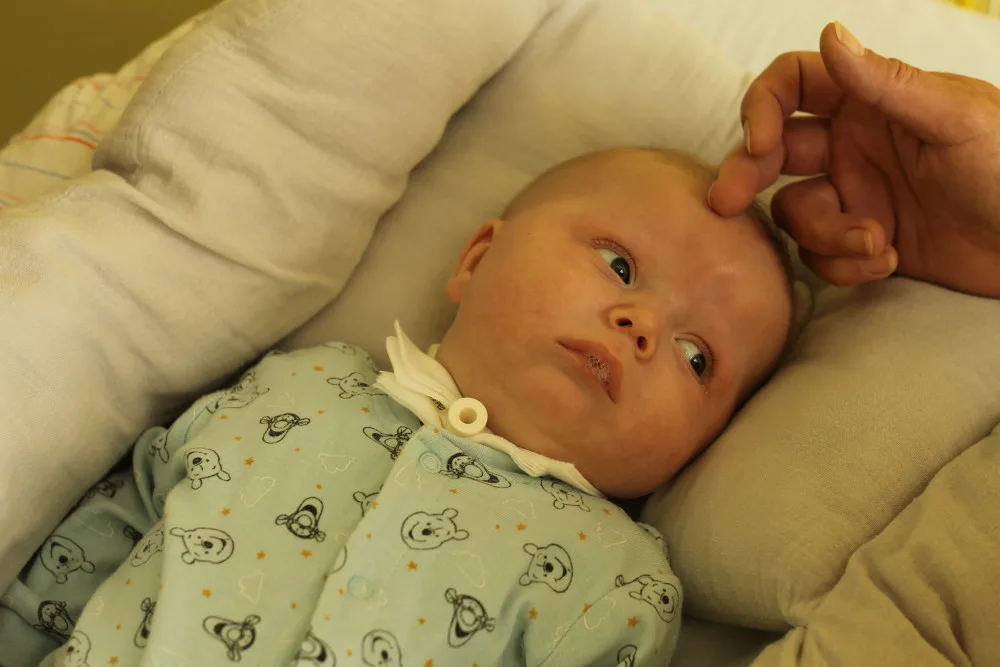 Vdechl plodovou vodu a prodělal tracheostomii. Půlroční Jiříček teď potřebuje speciální péči ve vzdálené nemocnici