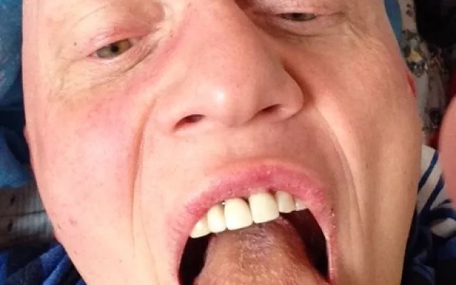 Jazyk mění barvu