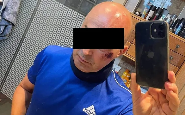 Cyklista se na Českolipsku střetl s traktorem, zachránila jej přilba. Kolo se silným nárazem rozlomilo