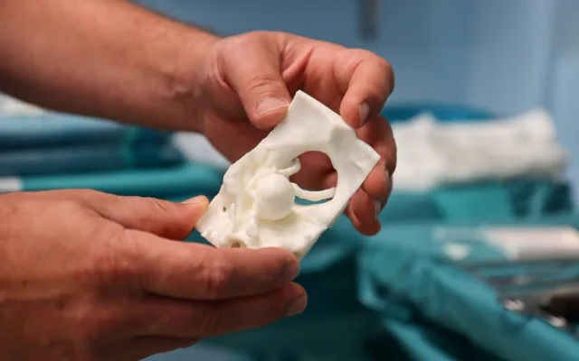 Lékařům v liberecké nemocnici pomáhá 3D tisk. Mohou navrhovat implantáty, tisknout kosti i nádory