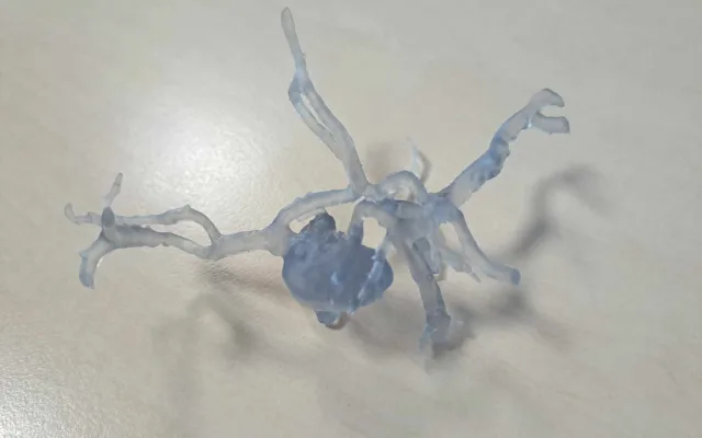 Spravit prasklý obratel na milimetr přesně dokážou v Liberci i díky 3D tisku. Vytisknout se dá nádor i cévy