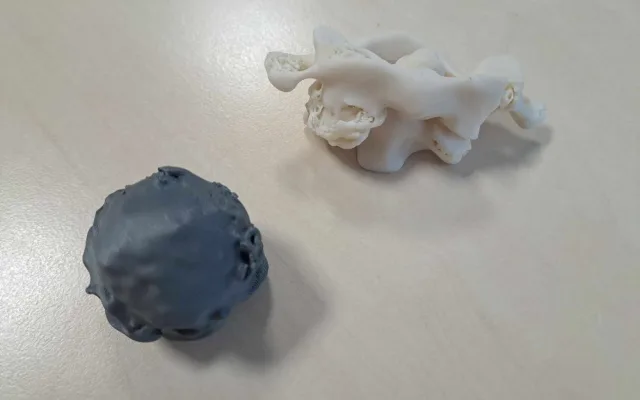 Spravit prasklý obratel na milimetr přesně dokážou v Liberci i díky 3D tisku. Vytisknout se dá nádor i cévy