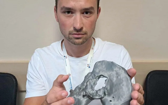 Spravit prasklý obratel na milimetr přesně dokážou v Liberci i díky 3D tisku. Vytisknout se dá nádor i cévy